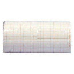 Representative photograph of ECG paper for seca CTCardioPad